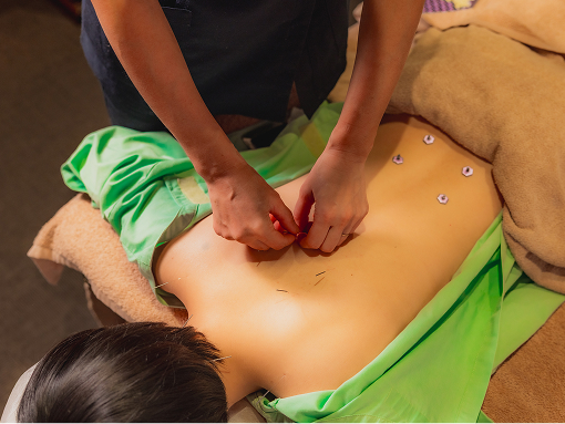 鍼灸治療の施術イメージ