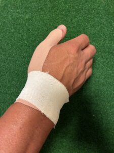 手首のテーピング ドケルバン