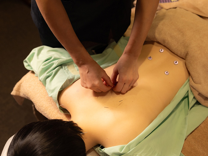 鍼灸治療の施術イメージ